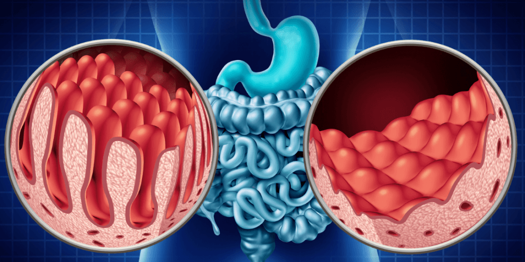 Gastrointestinal Surgery