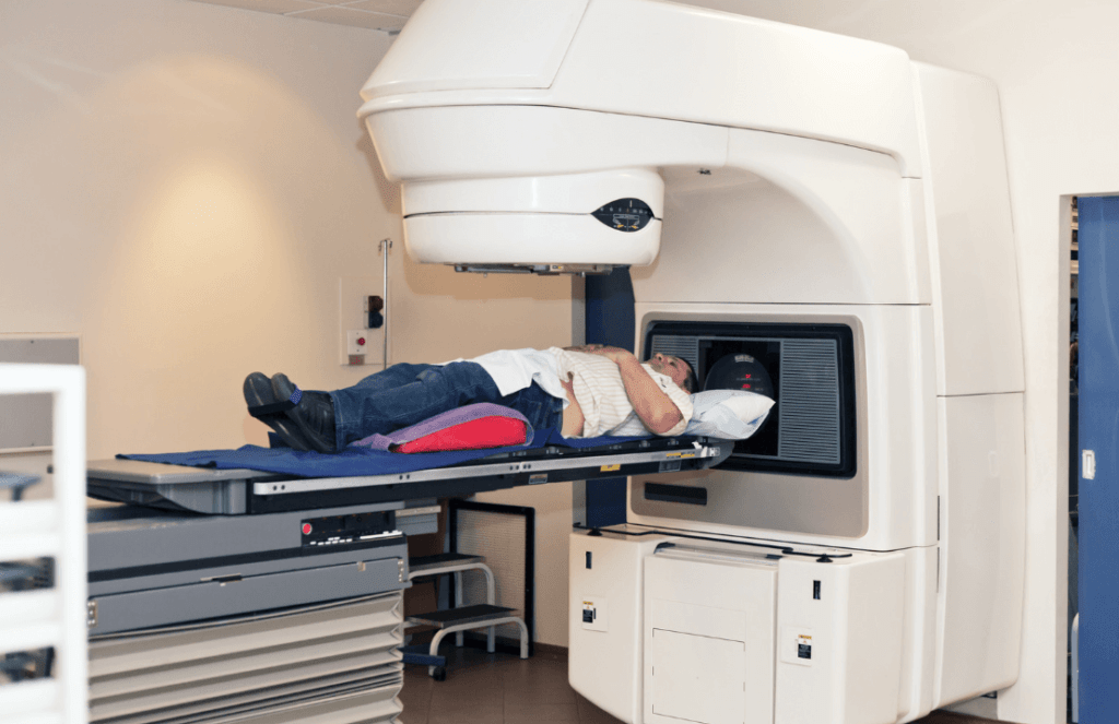 Radiotherapy